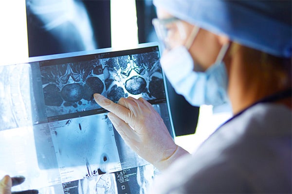 A CRO Strategy in Early Phase Oncology Trials