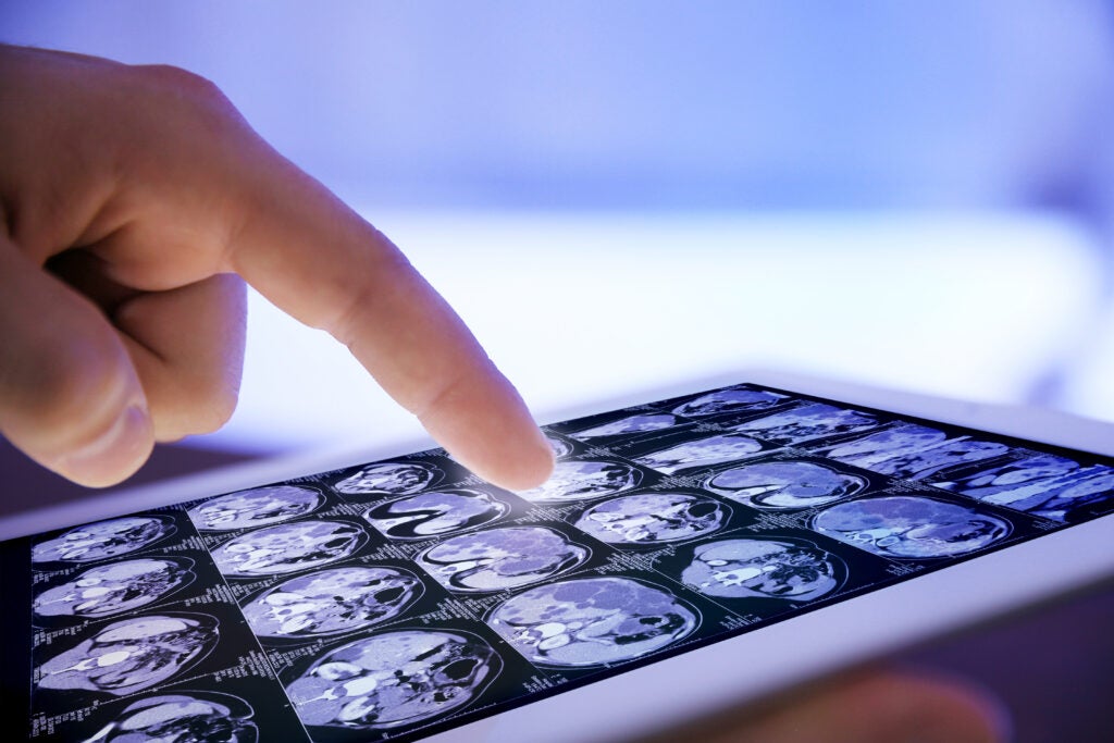 Align Your Clinical Trial Imaging Strategy with Patient Expectations | 5 Ways CROs Can Future Proof Their Medical Imaging Strategy Series
