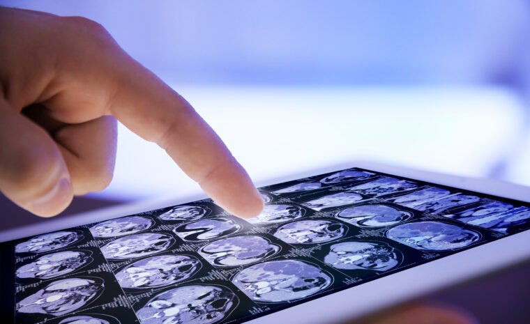 DCTs and Patient Expectations